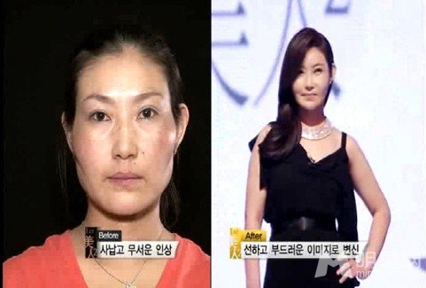 韩国整容节目堪称改头换面 中年大婶变小张曼玉