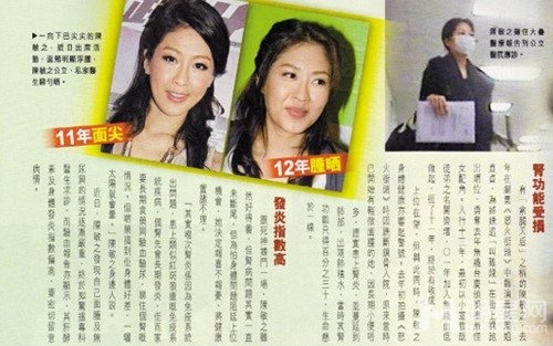港女星陈敏之免疫系统出问题 疑患红斑狼疮(图)