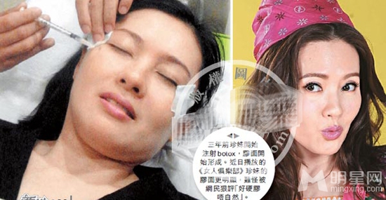李丽珍整容过度不忍直视 女神形象幻灭