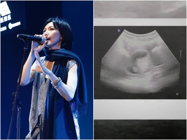有爱！孙燕姿新曲预告公开肚中娃B超影片和心跳声