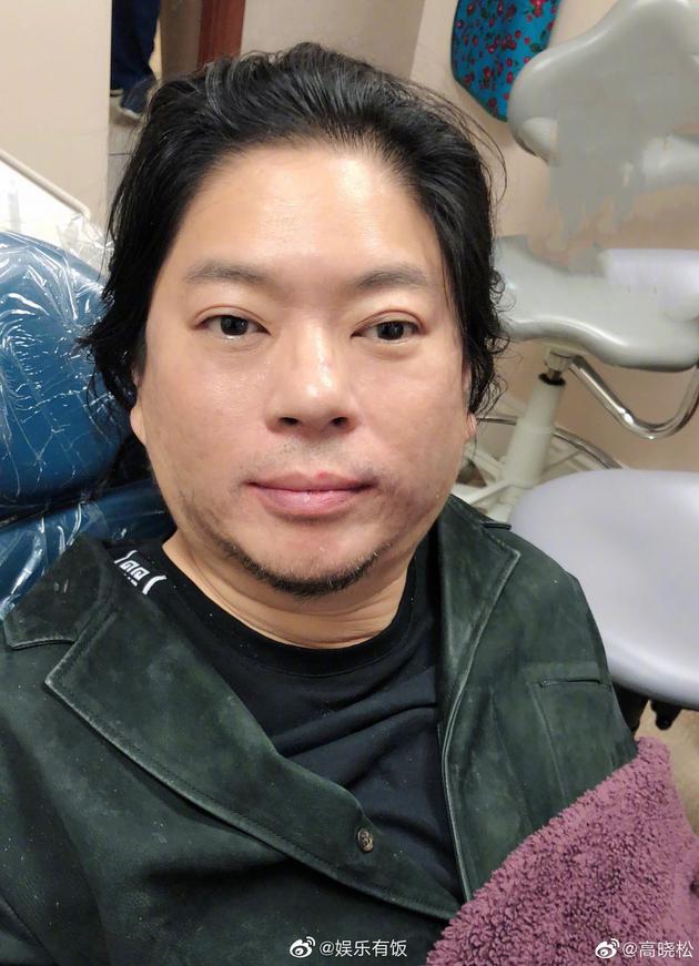 高晓松