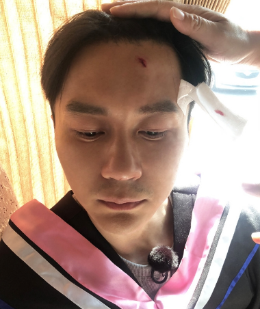 李晨被学士帽砸伤