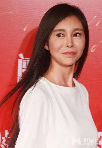 巩新亮整容毁脸僵硬笑容惊呆路人_图-1