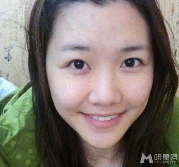 刘语熙被曝整容昔日银盆脸曝光_图-3