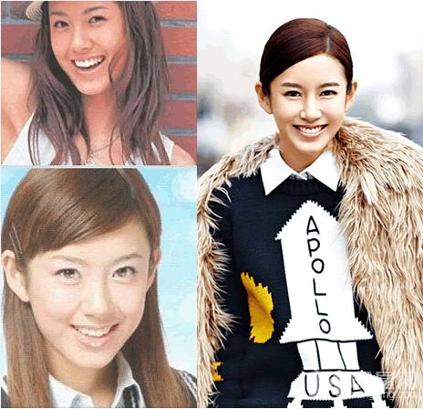 小三张子萱承认整容整容前后对比照曝光_图-8