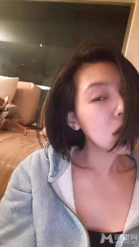 小S微博自拍疑似家暴左脸伤痕曝光_图-4