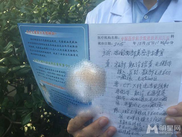 Angelababy面部鉴定:无任何动刀痕迹_图-3