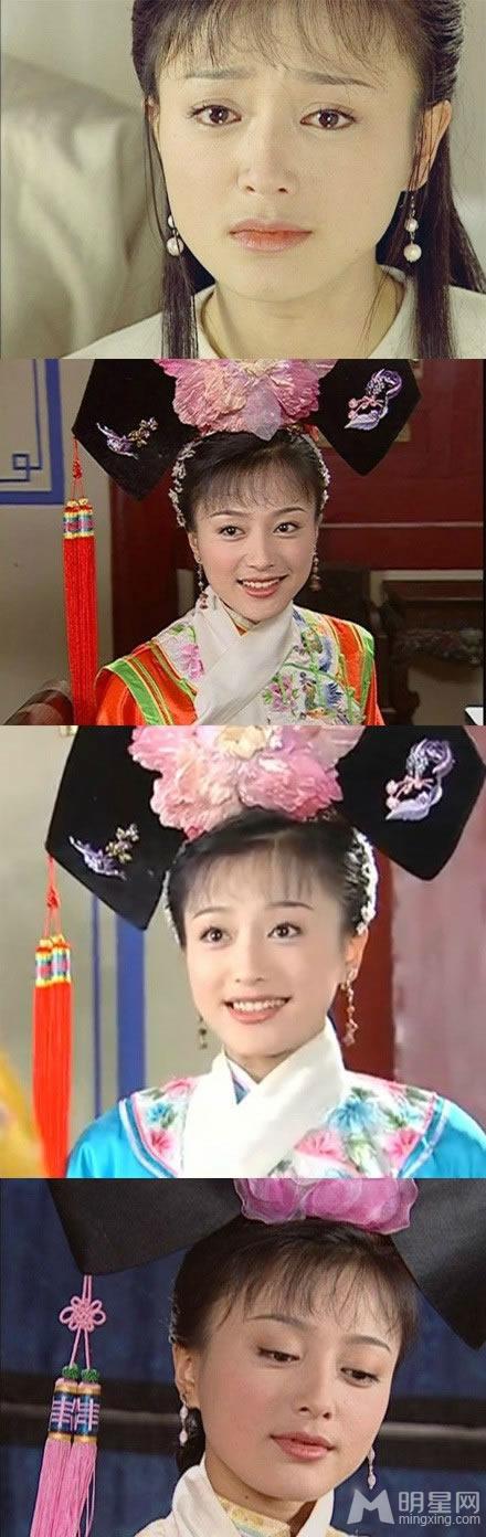 秦岚整容对比照神雕剧照脸僵面瘫_图-1