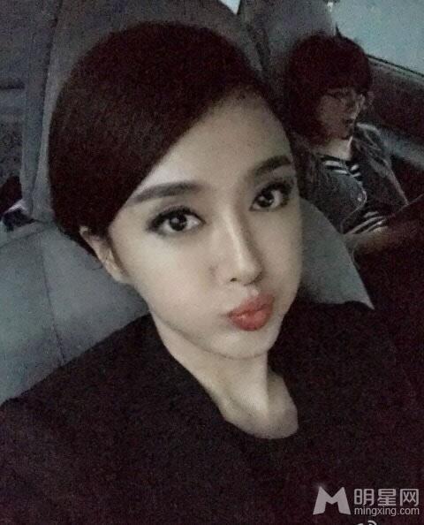 秦岚整容对比照神雕剧照脸僵面瘫_图-5